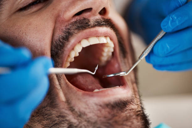 Best After-Hours Dental Trauma Care in Mechanicsburg, OH
